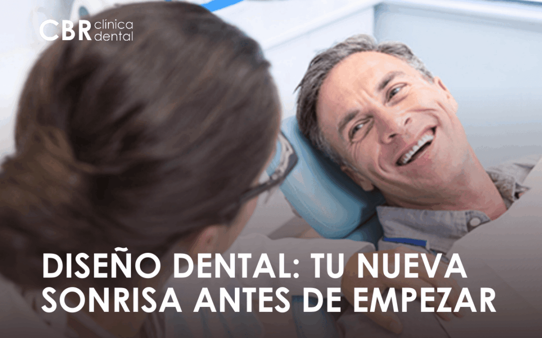 ¿Qué es el diseño dental y cuándo es recomendable realizarlo?