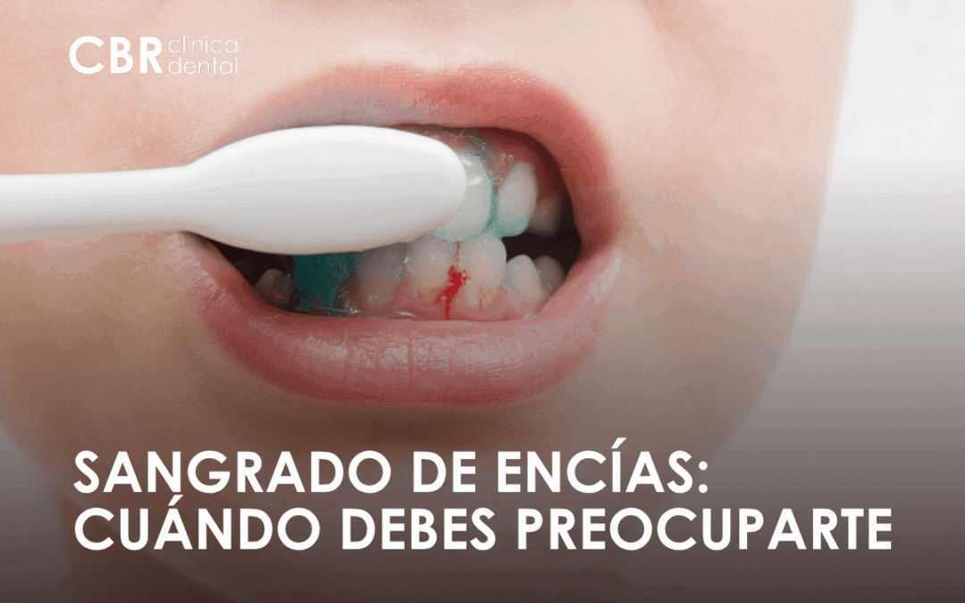 persona con sangrado de encías durante el cepillado dental