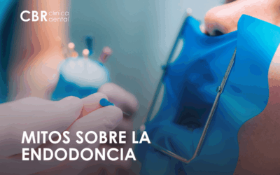 Mitos sobre la endodoncia: lo que de verdad debes saber